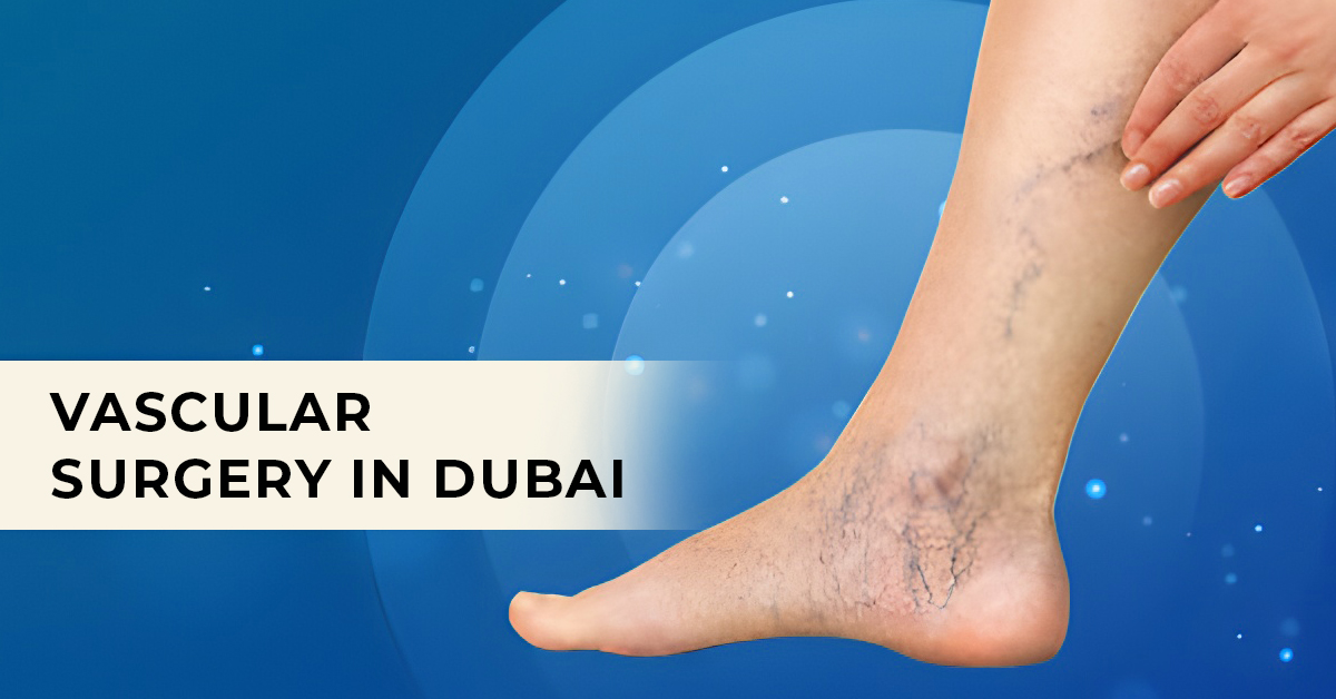 Vascular Surgery in Dubai