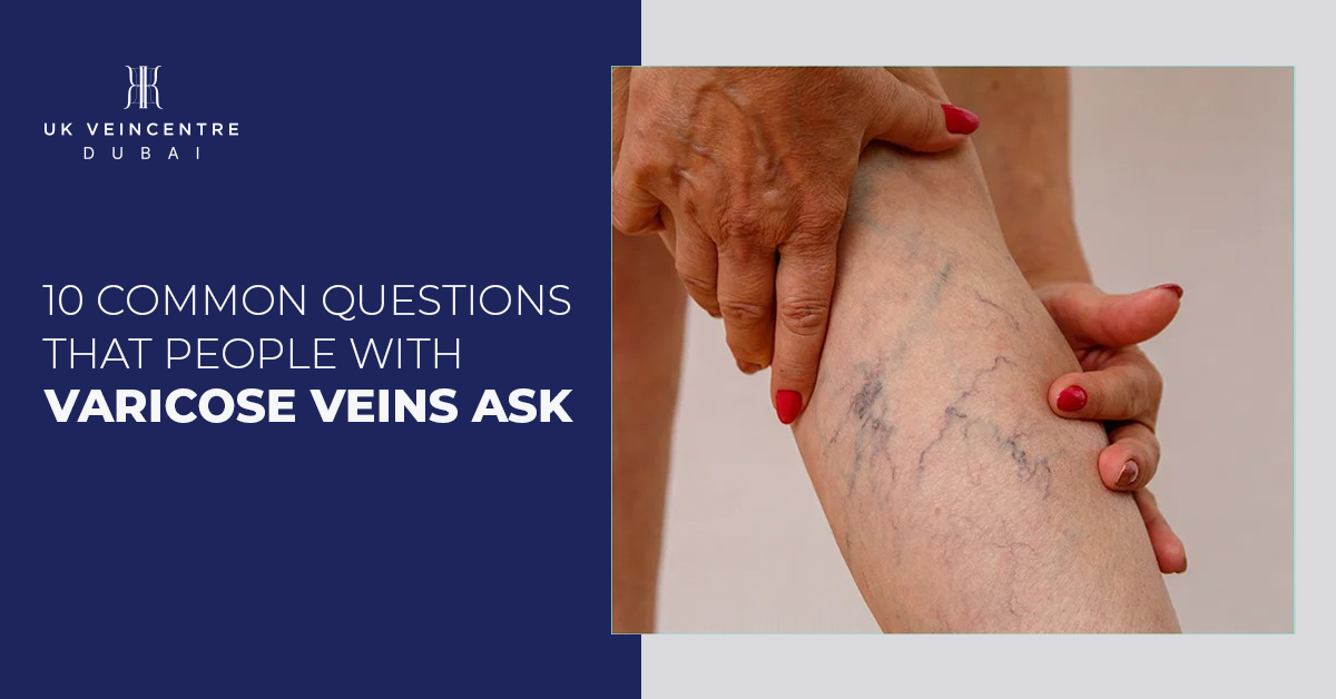 10 common questions that people with varicose veins ask - UK Veincentre